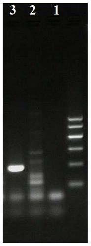 LbKN1 gene derived from Lubao No.1 and application of LbKN1 gene