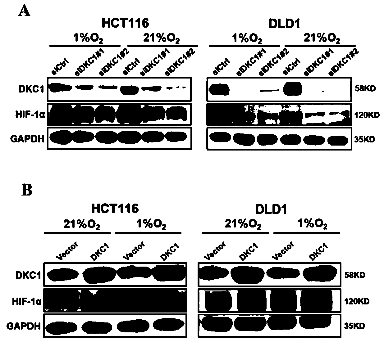 Application of DKC1 and HIF-1 alpha in the synergistic treatment of colorectal cancer