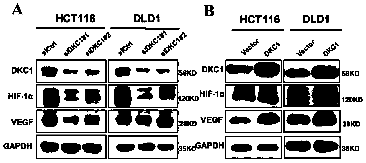 Application of DKC1 and HIF-1 alpha in the synergistic treatment of colorectal cancer