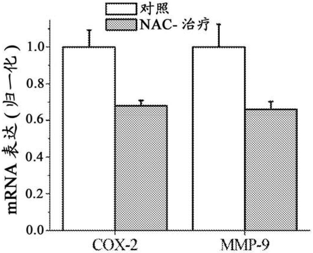 N-acetyl-l-cysteine for the treatment of endometriosis