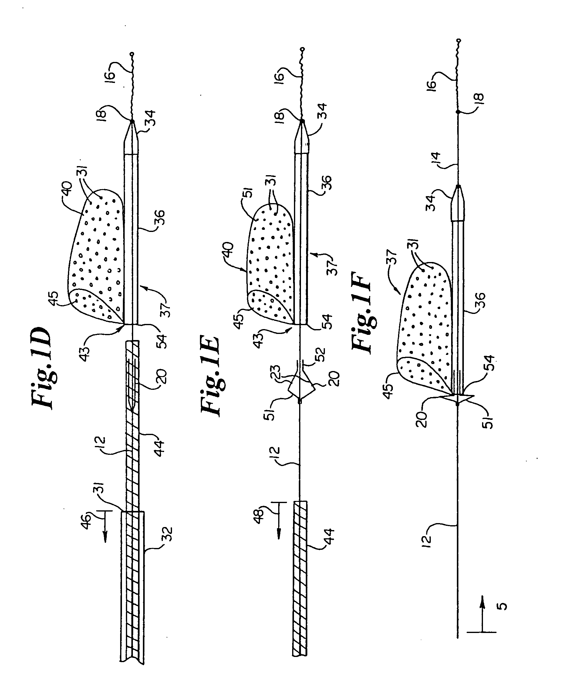 Vascular embolic filter devices and methods of use therefor