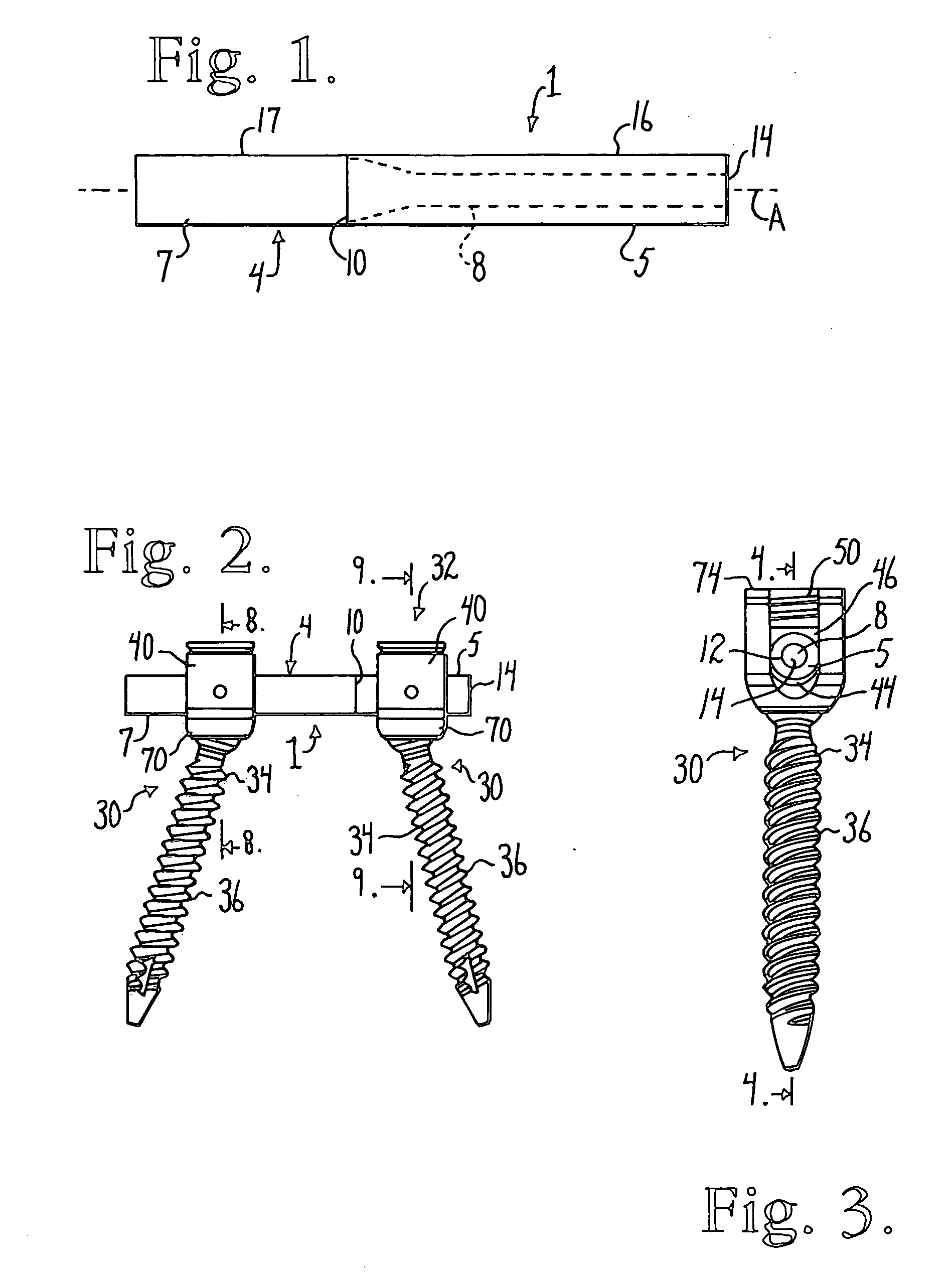 Elastic covered dynamic stabilization connector and assembly