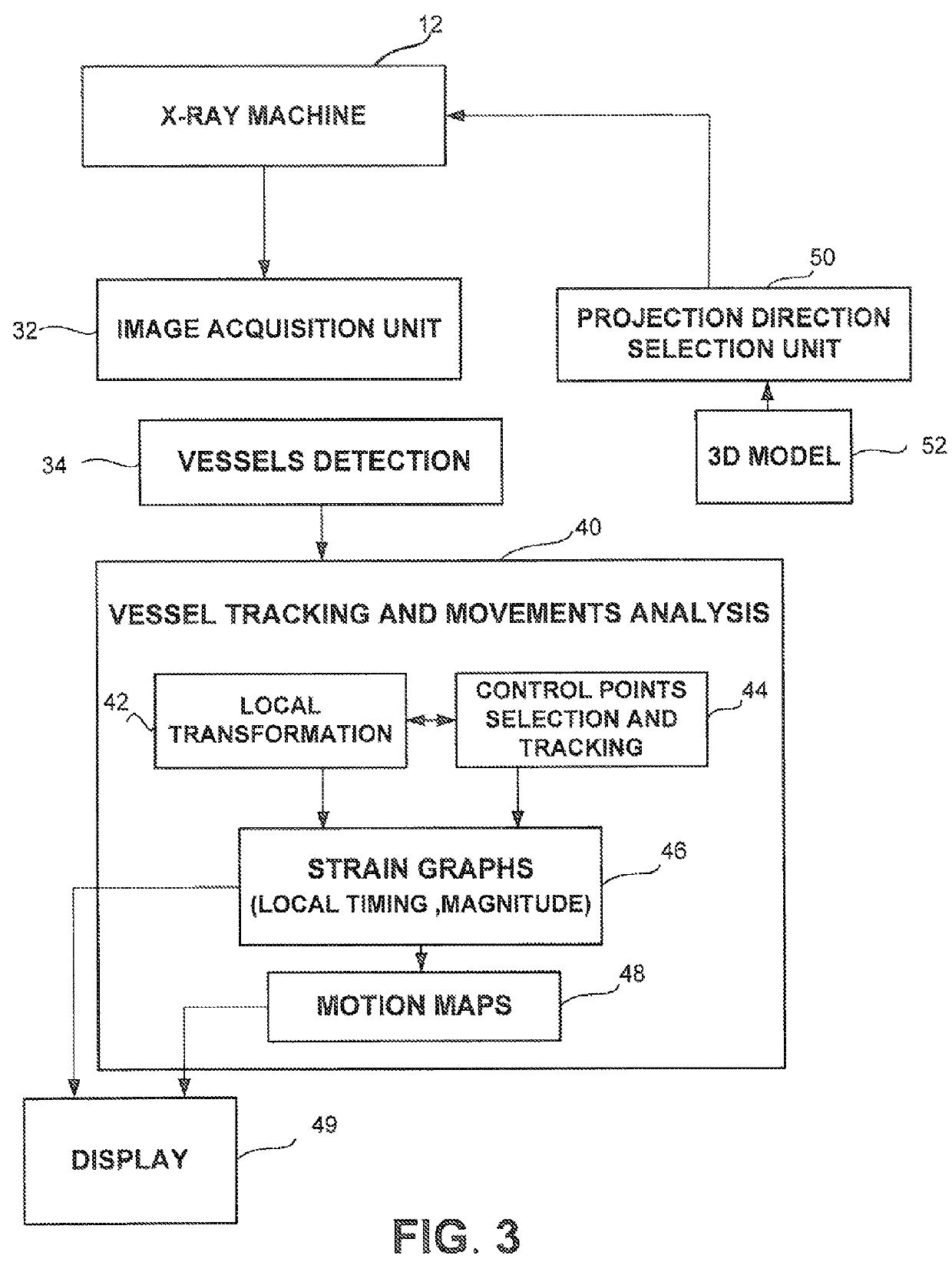 Method and system for detecting and analyzing heart mechanics