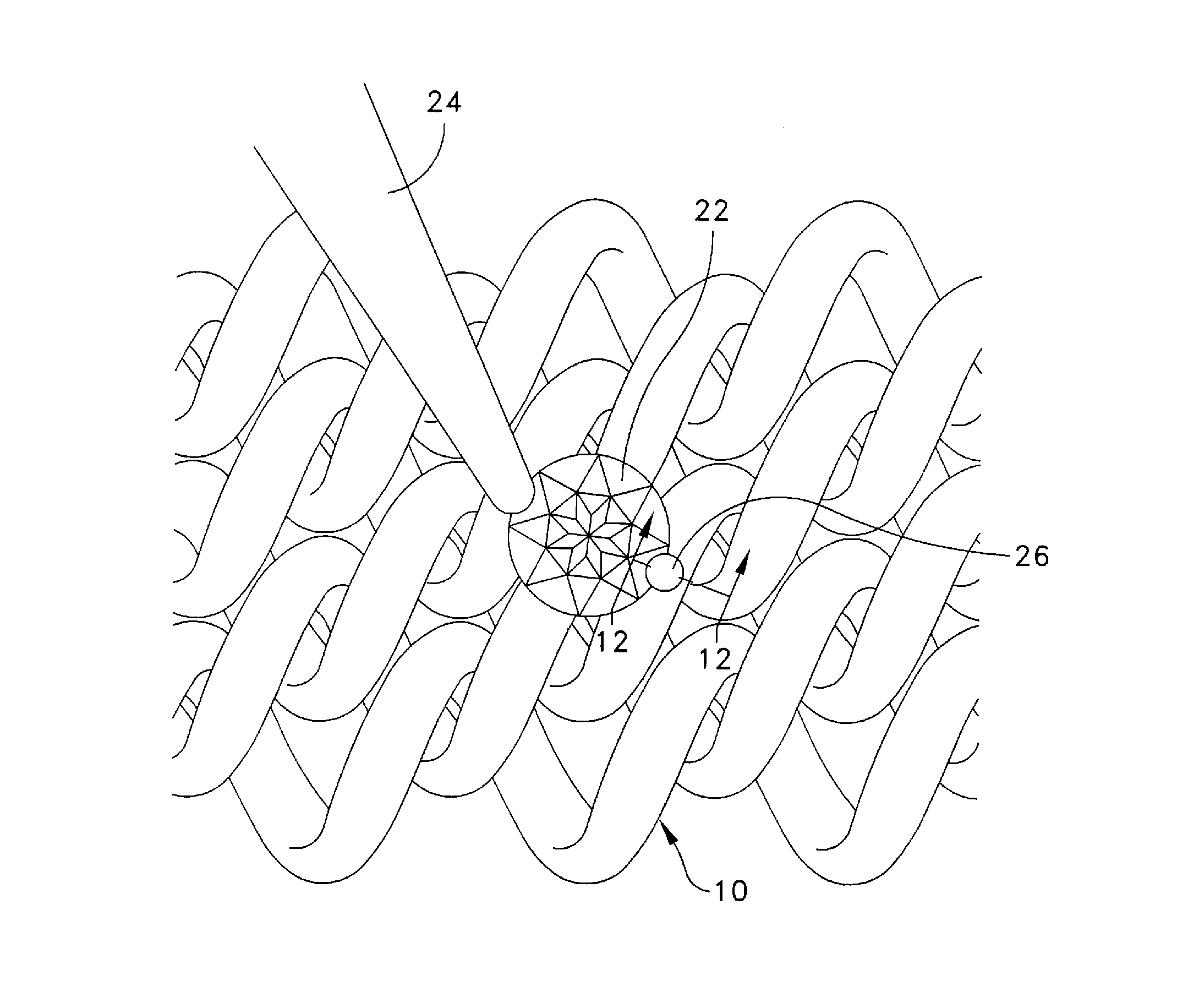 Ornamented metallic mesh and method of making same