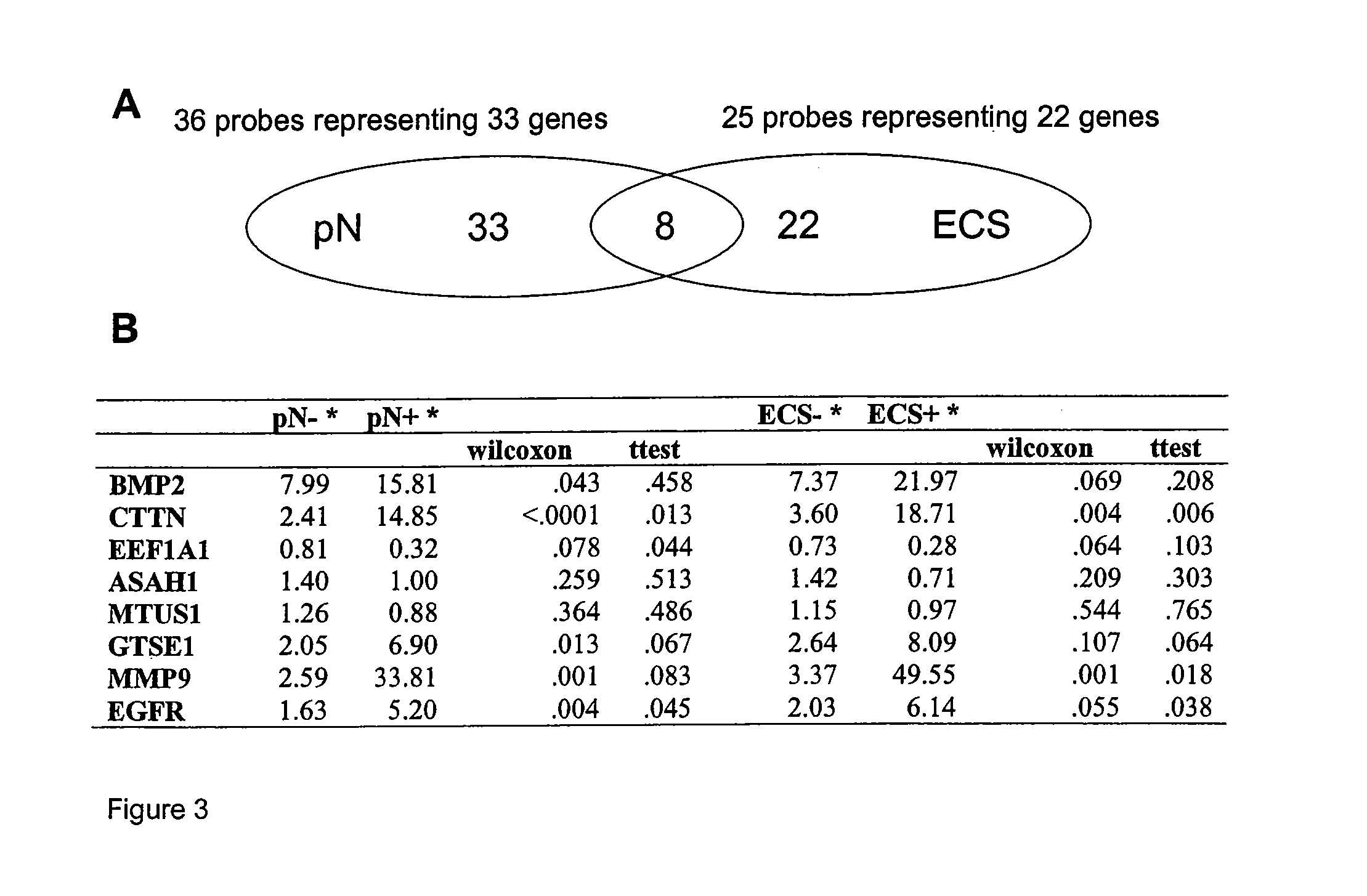 Biomarkers for oral tongue cancer metastasis and extracapsular spread (ECS)