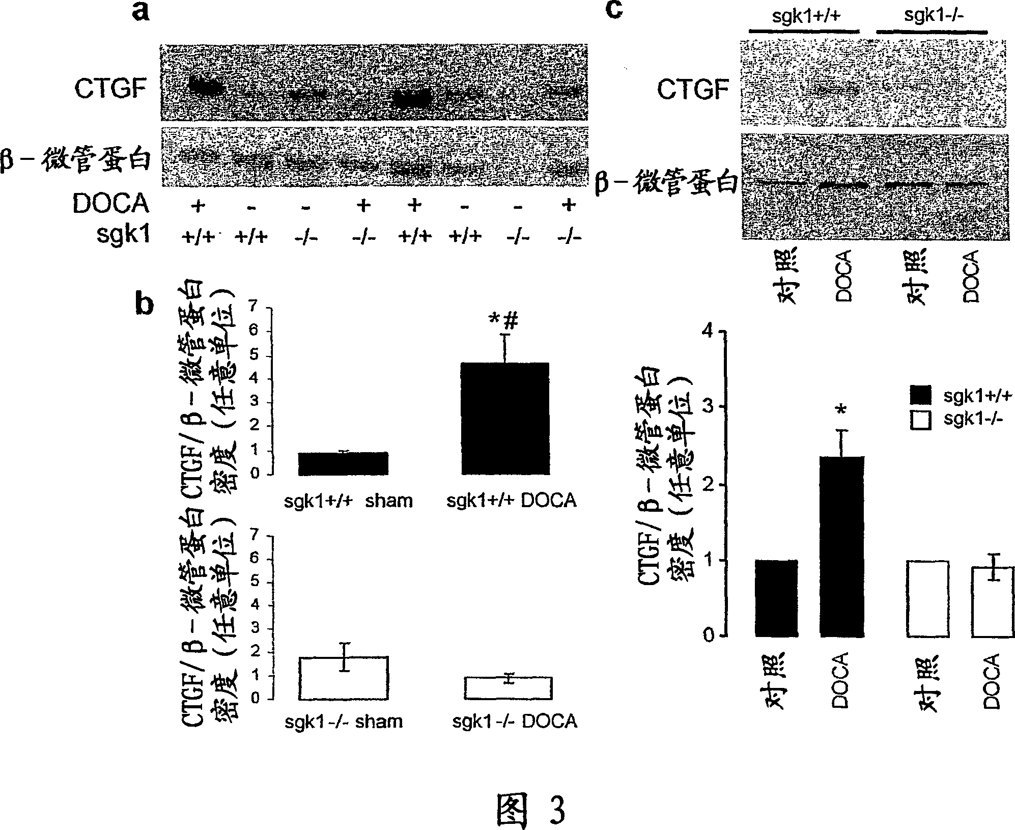 Methods for interfering with fibrosis
