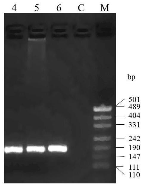 Haplotype molecular markers related to high fecundity of sheep, screening method and application