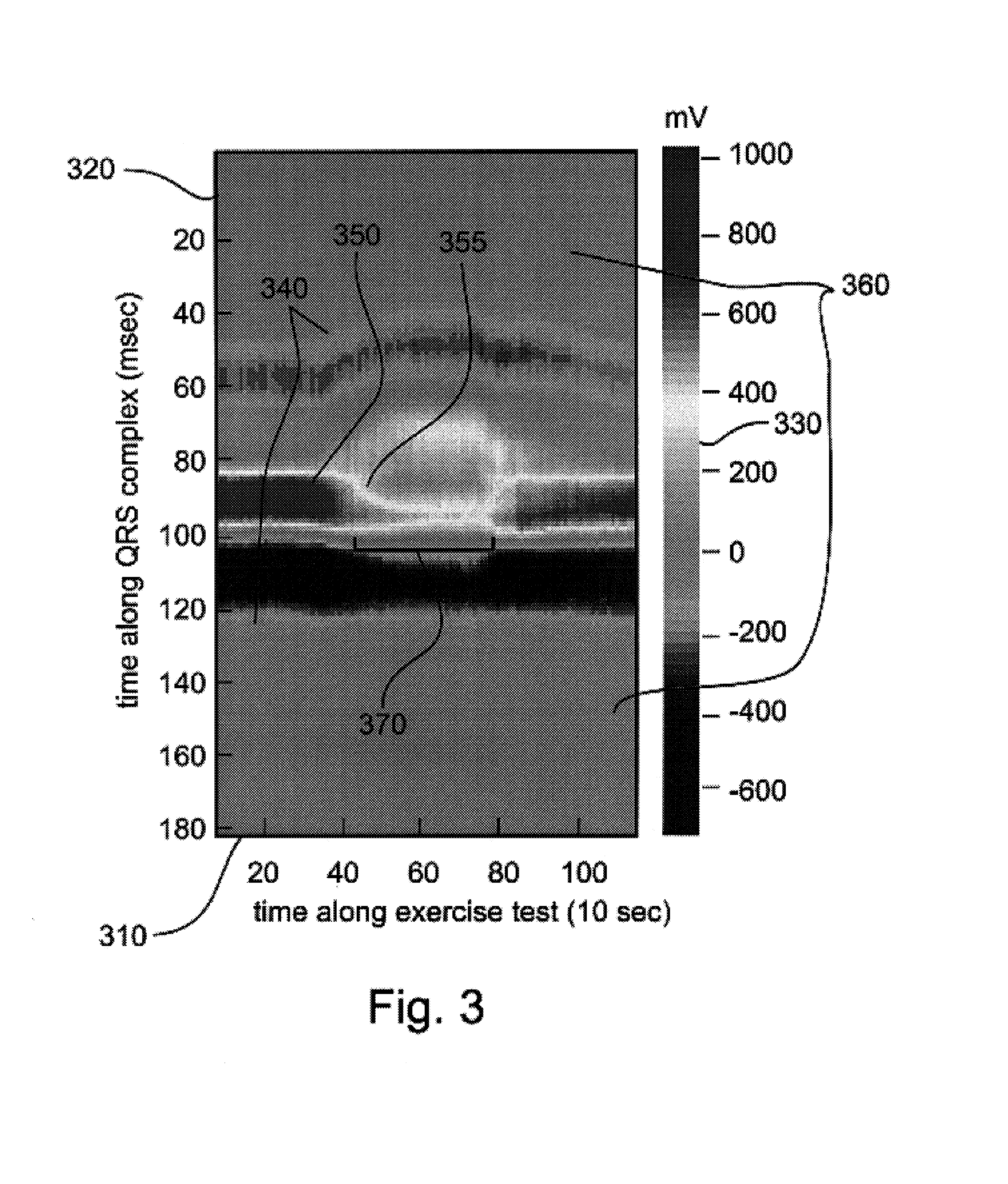 Apparatus and method for efficient representation of periodic and nearly periodic signals for analysis