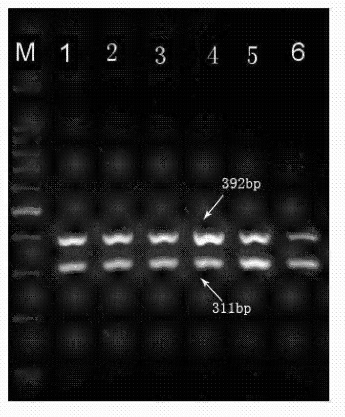 Multiple PCR primer used for simultaneously detecting infectious Bovine Rhinotracheitis virus and akabane virus as well as its design method