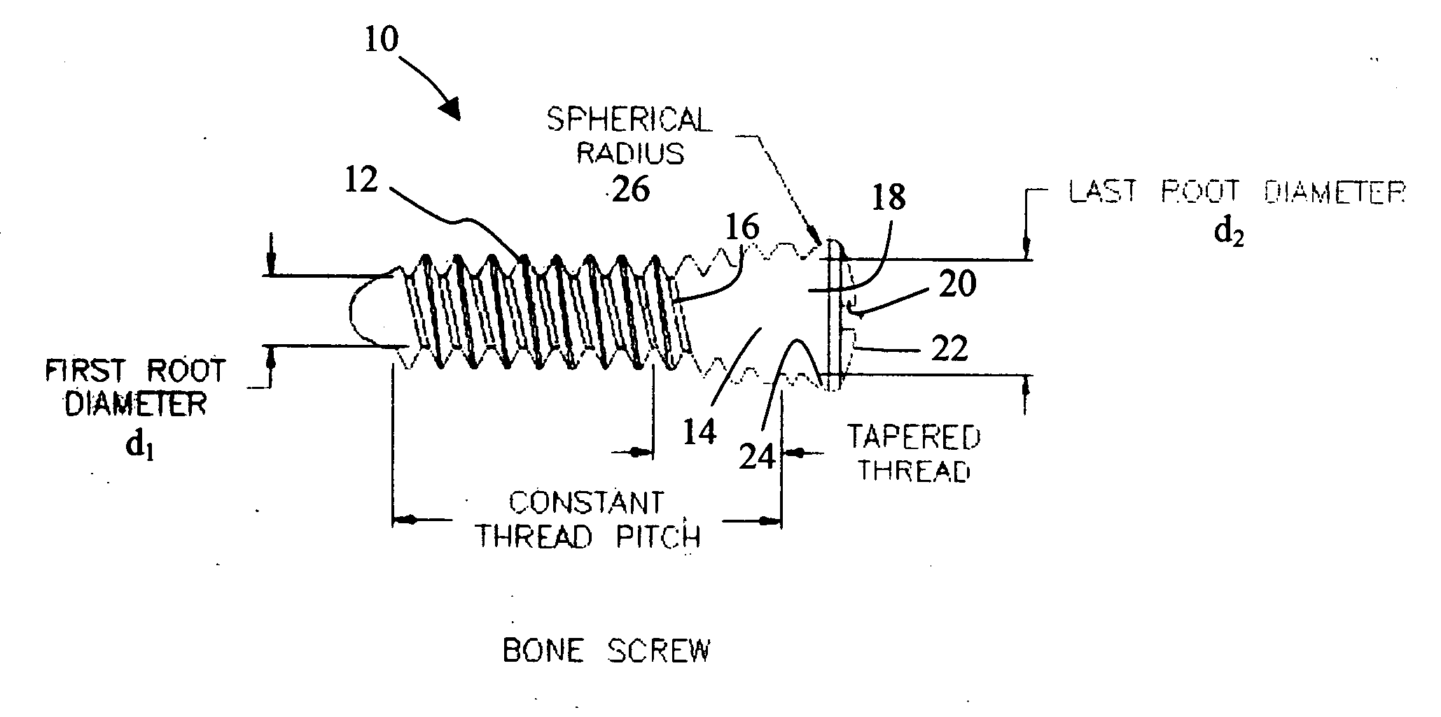 Bone plate with interference fit screw