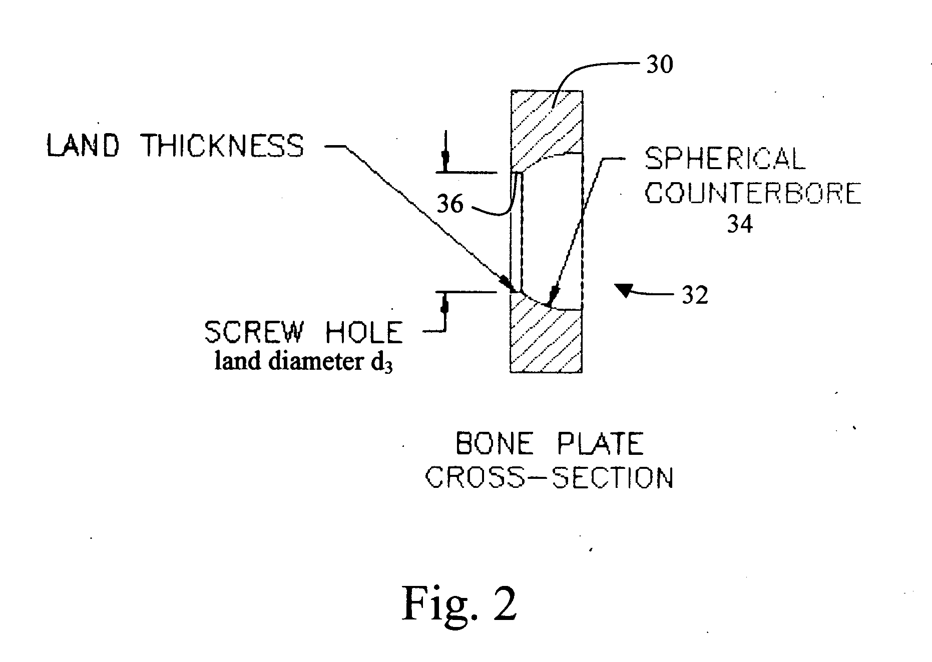 Bone plate with interference fit screw