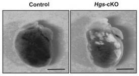 Application of doxycycline in preparation of medicine for treating and/or preventing and/or relieving and/or improving cardiomyopathy