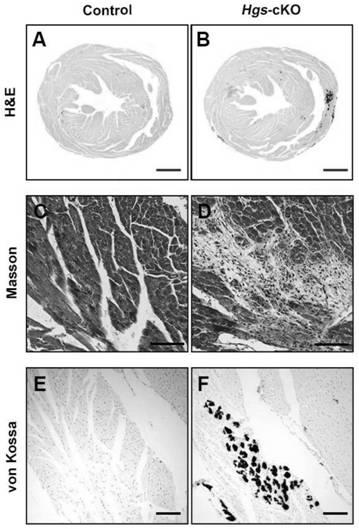 Application of doxycycline in preparation of medicine for treating and/or preventing and/or relieving and/or improving cardiomyopathy