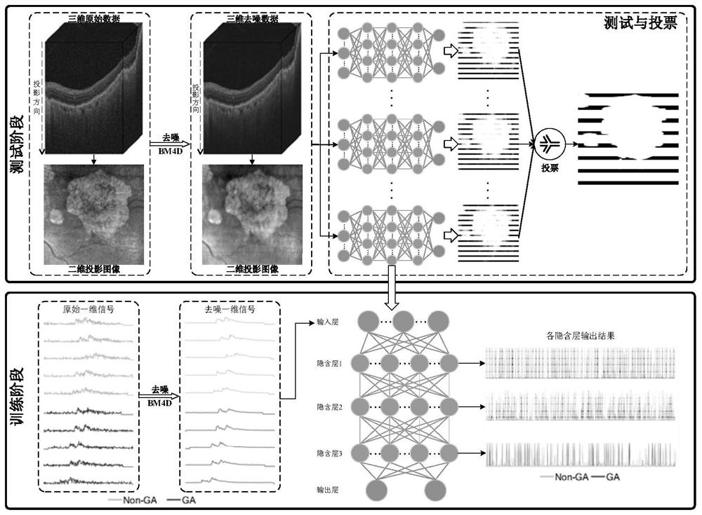 Segmentation method of GA lesion in sd-oct image based on deep voting model
