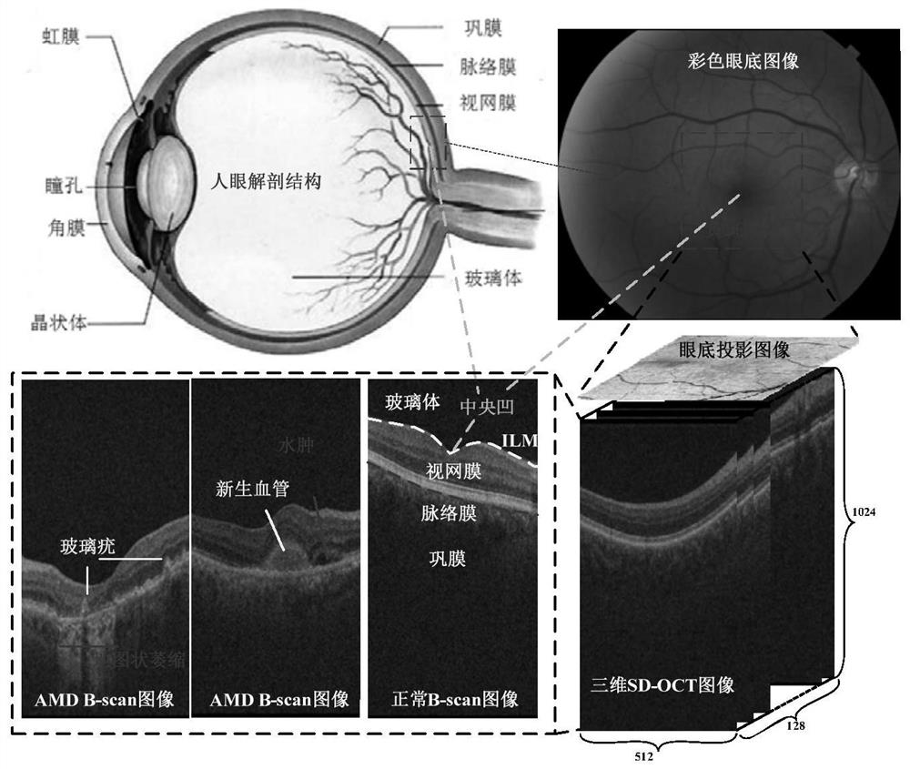 Segmentation method of GA lesion in sd-oct image based on deep voting model