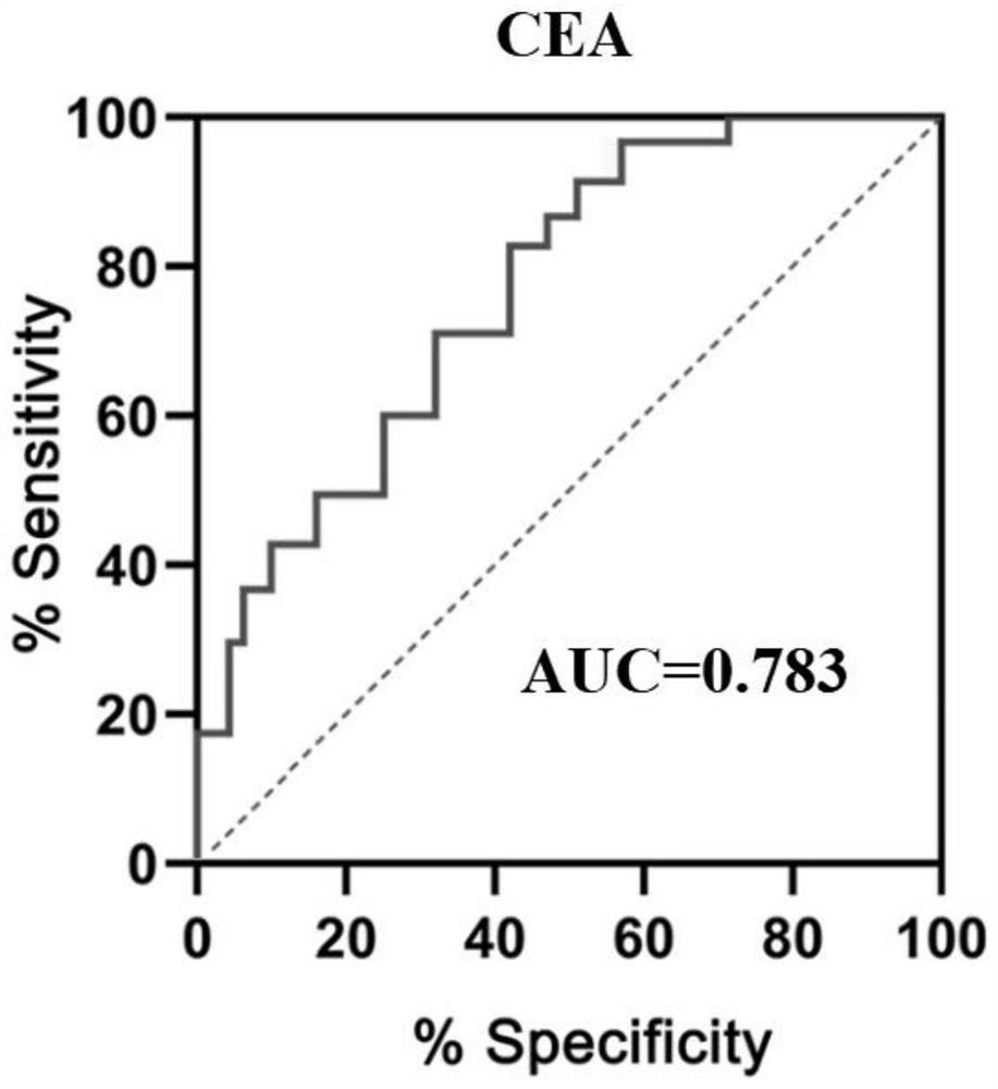 Tumor gene diagnosis marker combined with carcinoembryonic antigen and application of tumor gene diagnosis marker