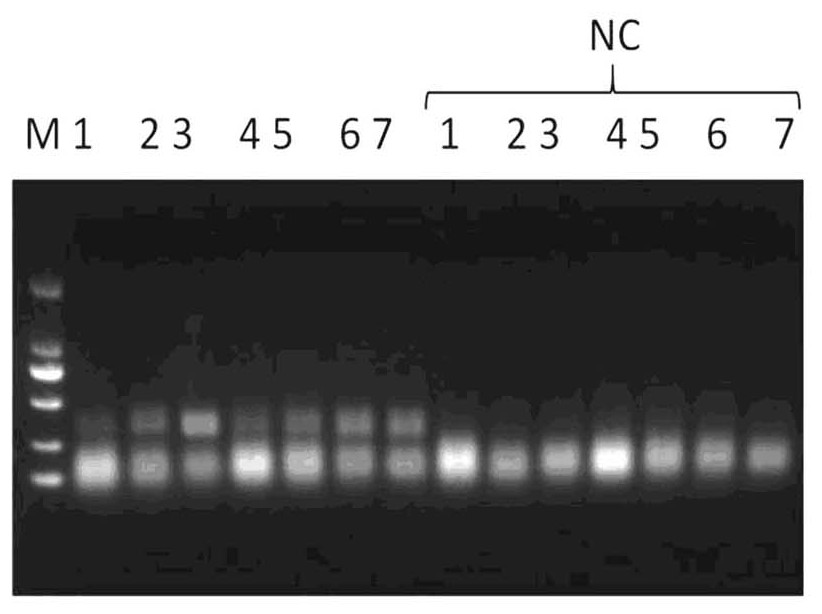 ERA nucleic acid test strip amplification kit for rapidly detecting feline herpes virus, preparation method and detection method