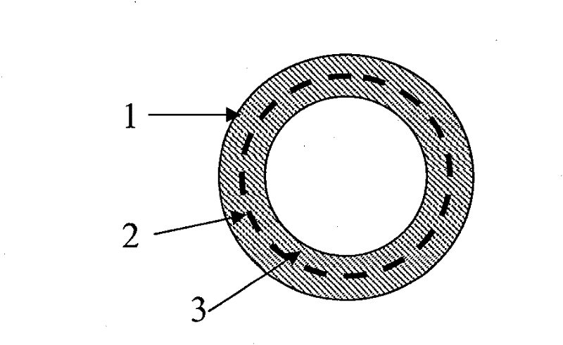 Bile duct support and preparation method thereof