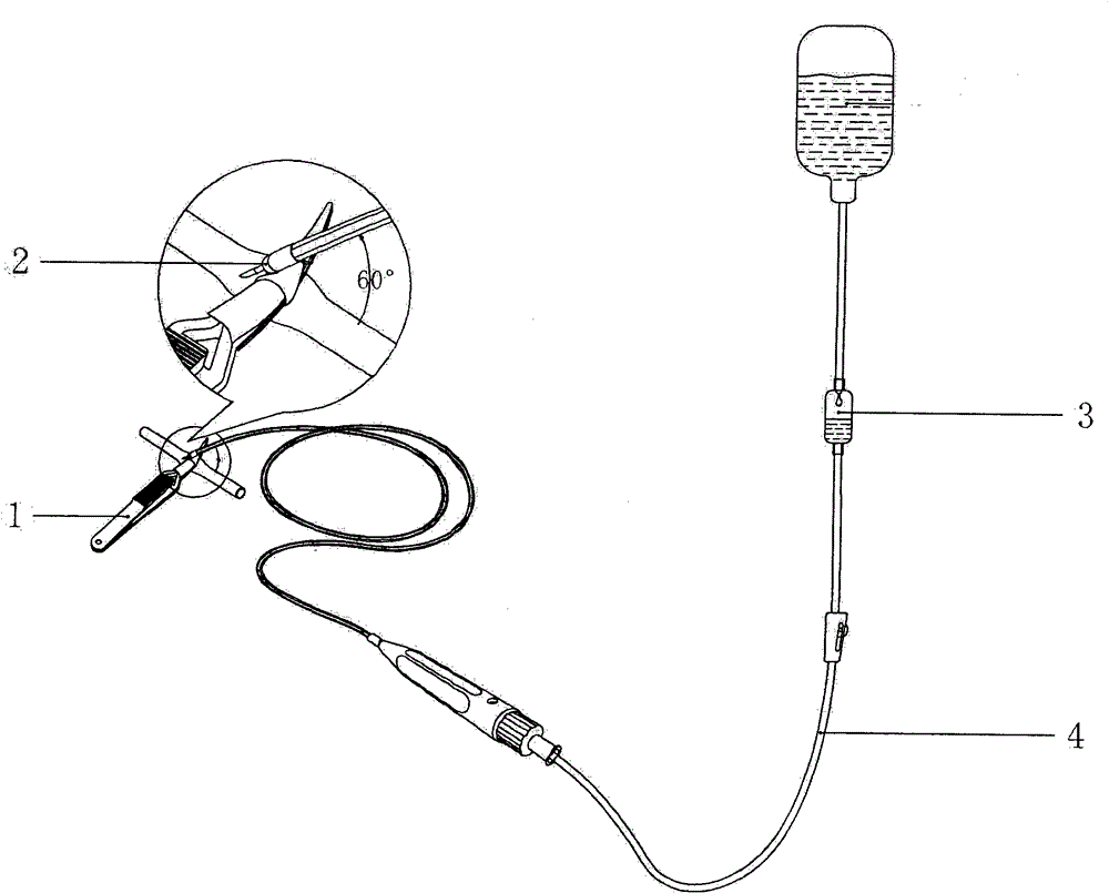 Renal artery blockage and cold infusion device for laparoscopic surgeries
