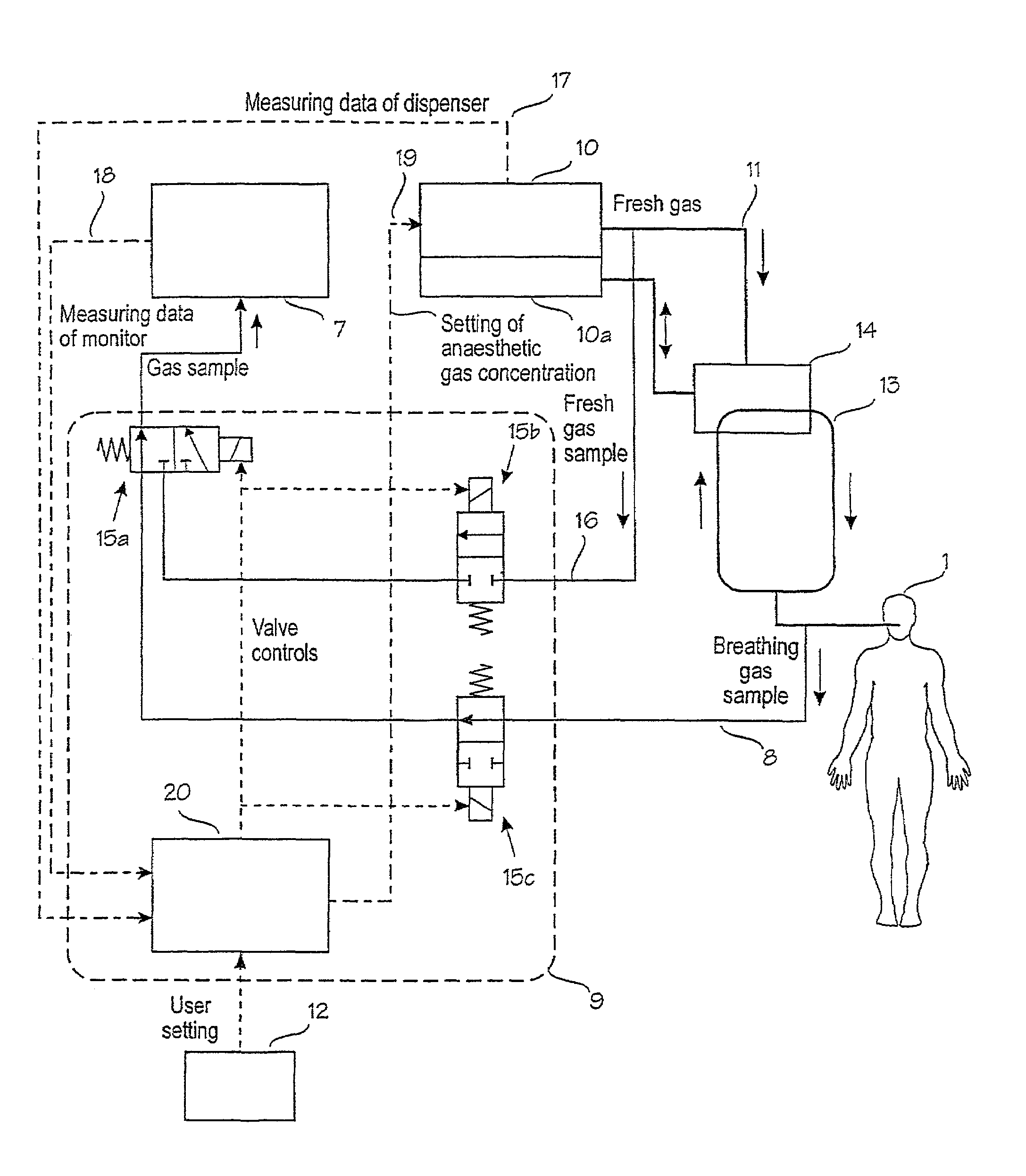 Arrangement in connection with feedback control system