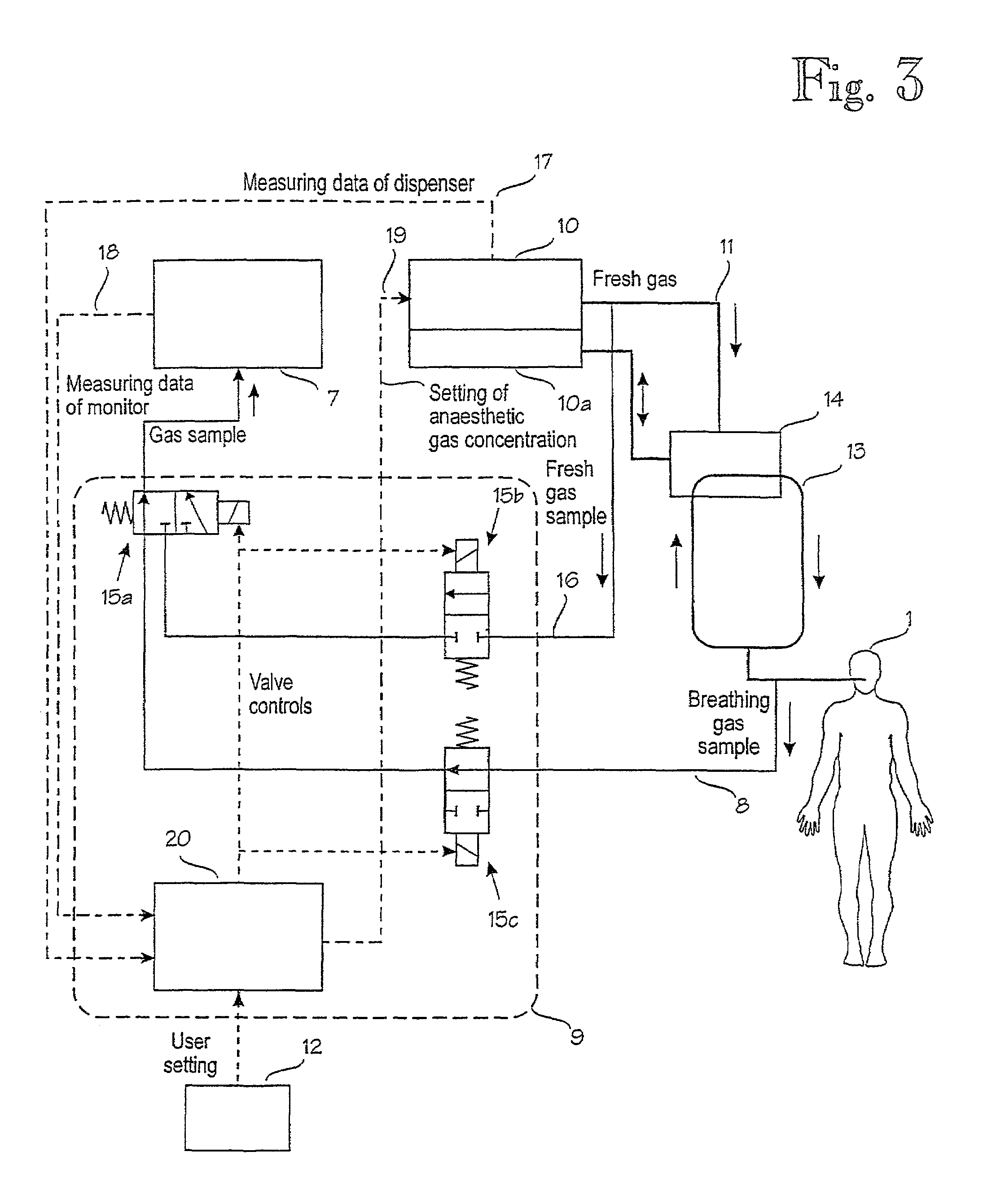 Arrangement in connection with feedback control system