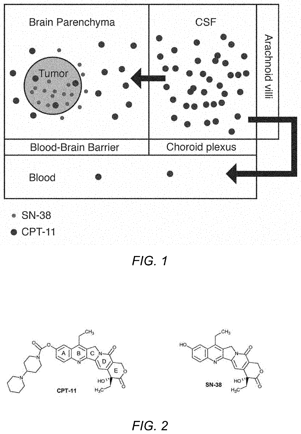 Direct brain administration of chemotherapeutics to the CSF for patients with primary and secondary brain tumors