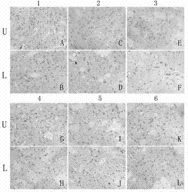 Traditional Chinese medicine composition for preventing parkinsonism and application of traditional Chinese medicine composition