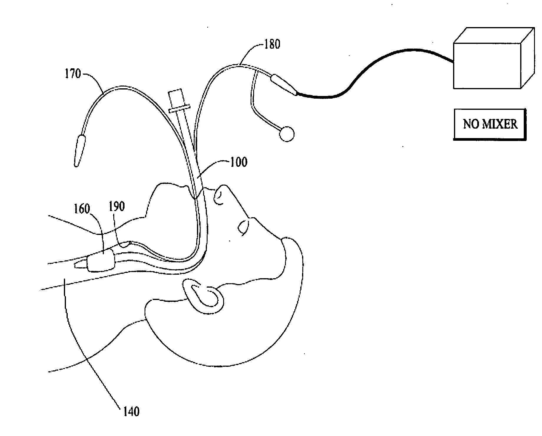Method and device to prevent ventilator acquired pneumonia using nitric oxide
