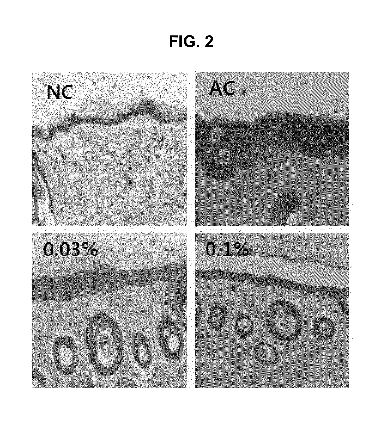 Composition comprising purine derivatives or salt thereof for preventing or treating atopic dermatitis