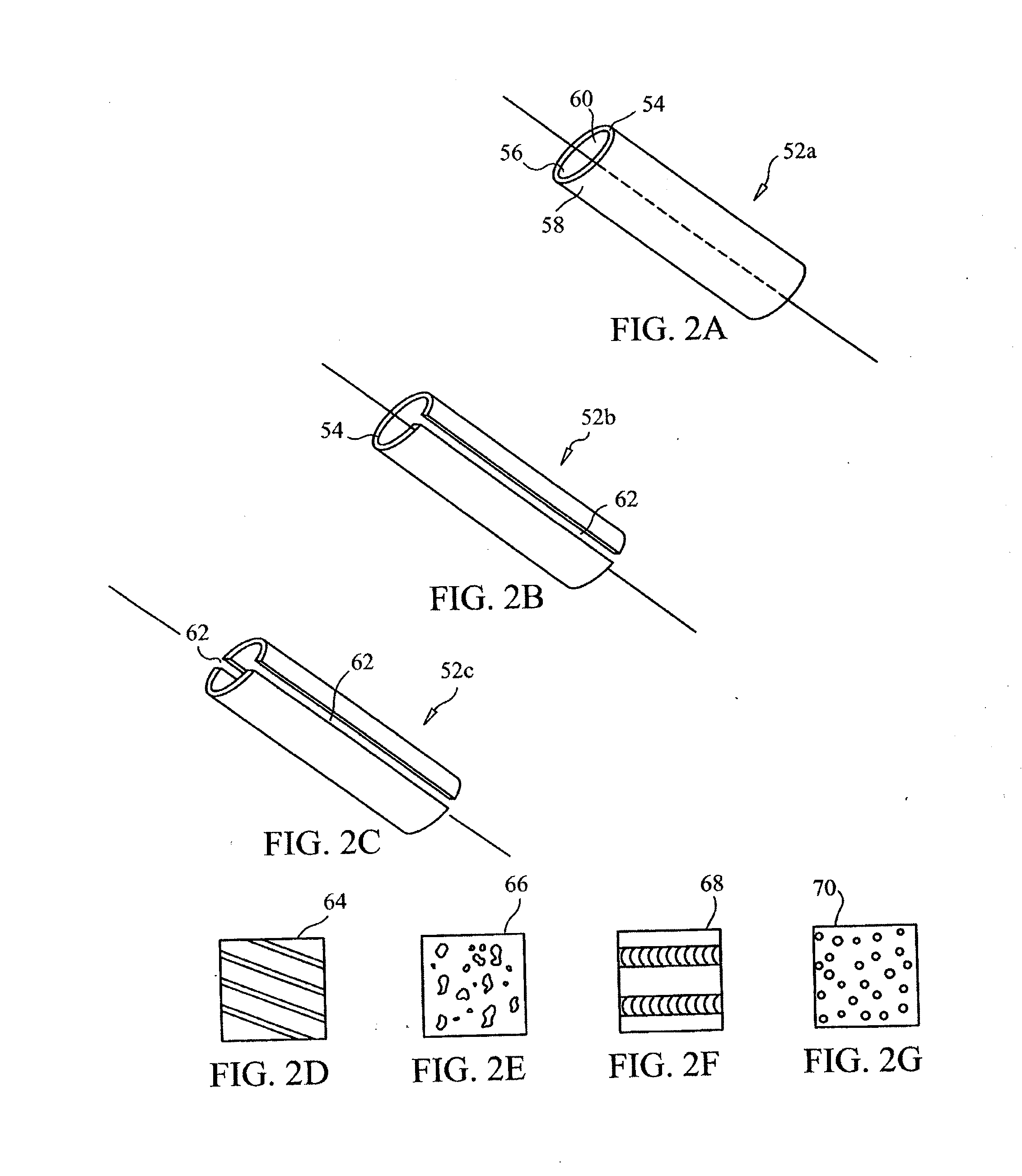 Devices and methods for stabilizing tissue and implants