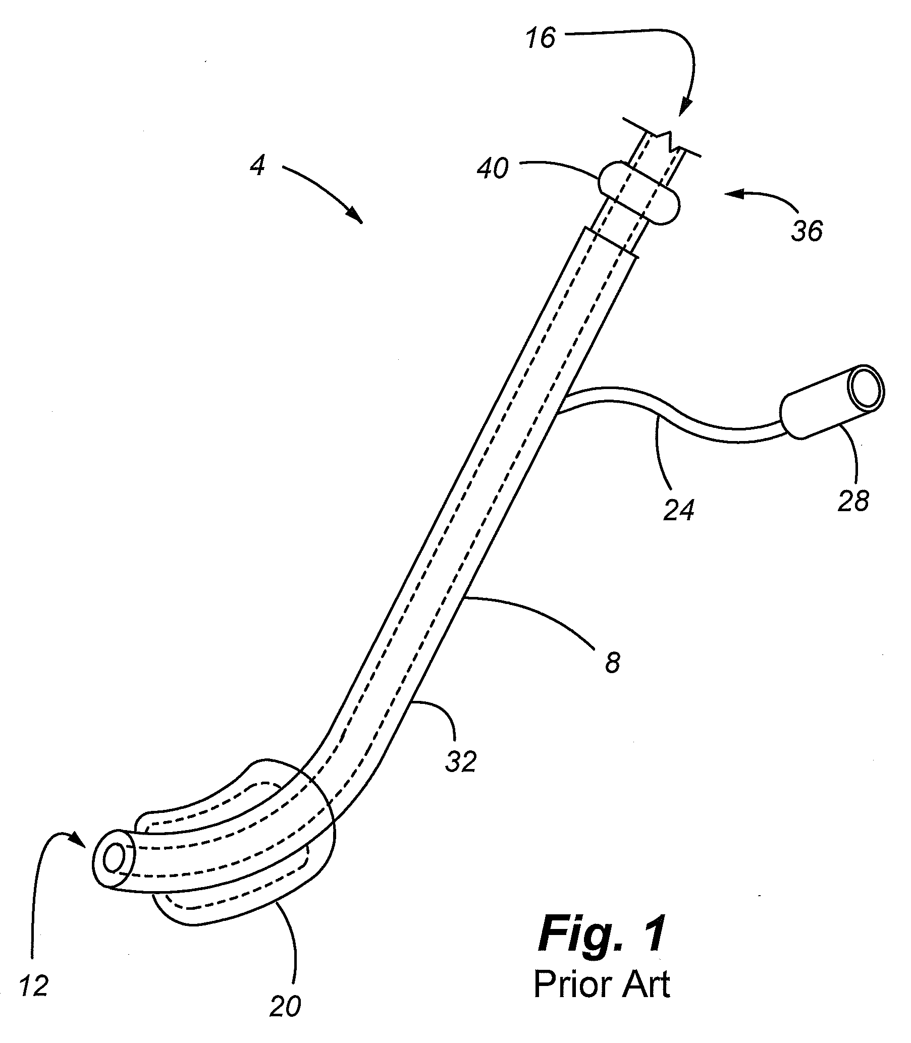 Wireless video stylet with display mounted to laryngoscope blade and method for using the same