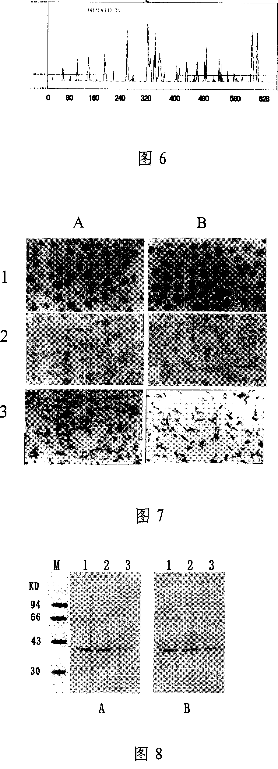 Method of preparing monoclonal antibody against human soluble mesothelin related protein