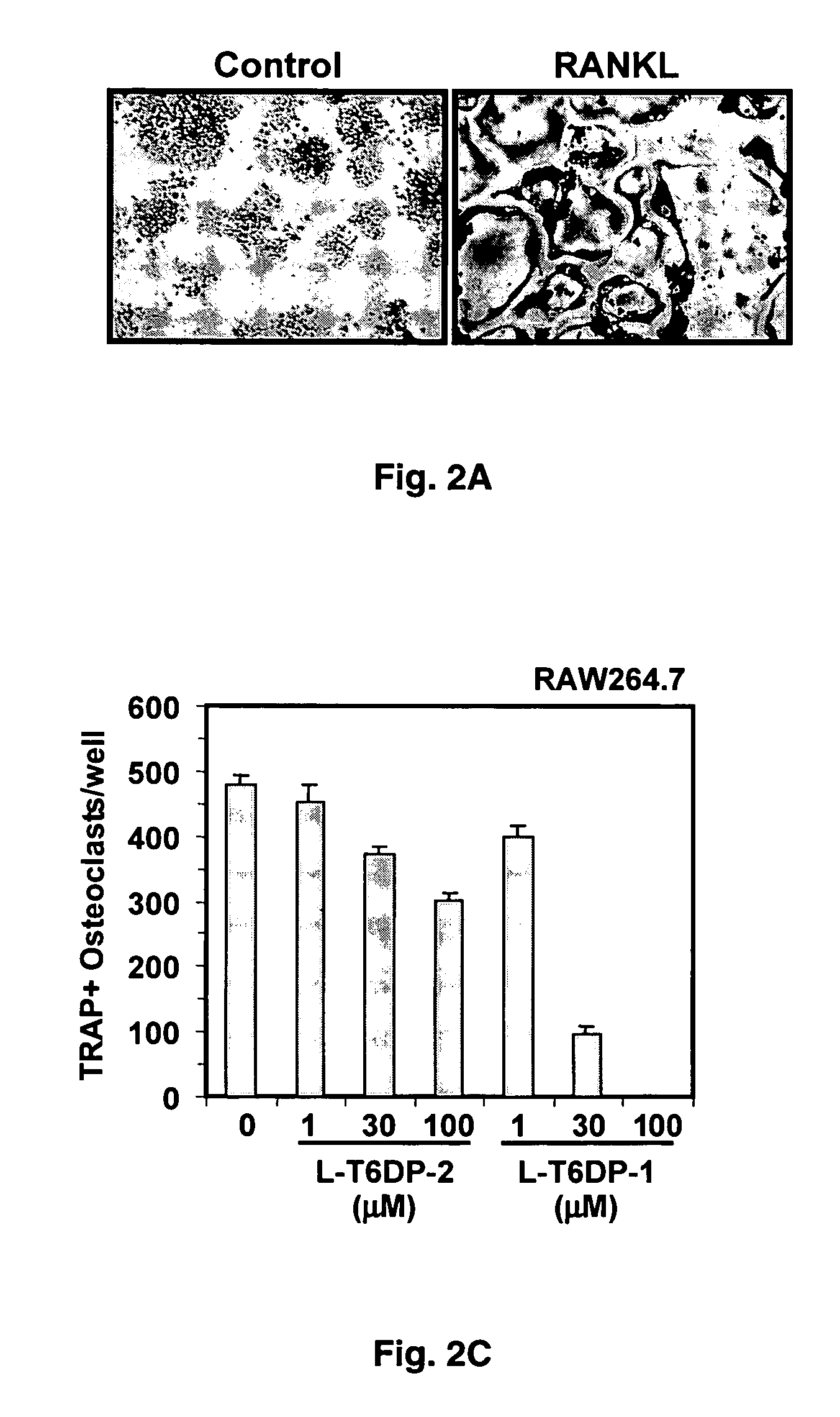 Inhibitors of receptor activator of NF-kappaB and uses thereof