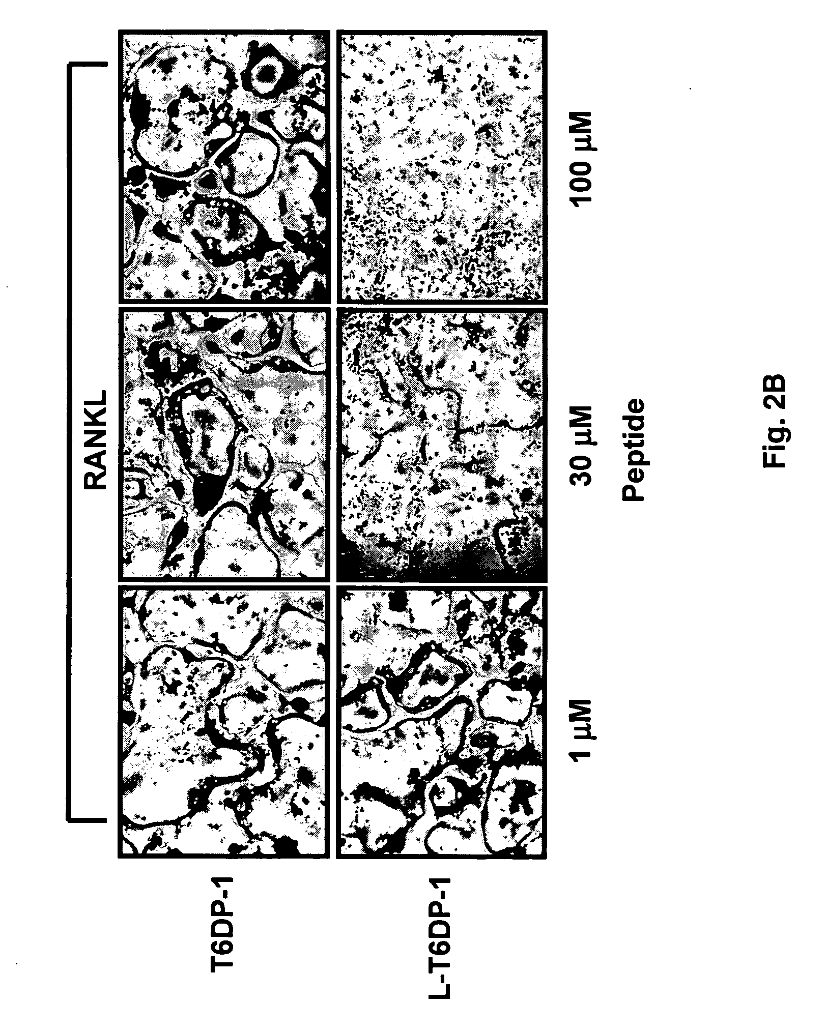 Inhibitors of receptor activator of NF-kappaB and uses thereof