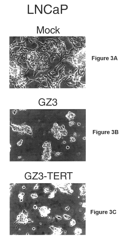 Recombinant adenovirus vectors that are replication-competent in tert-expressing cells