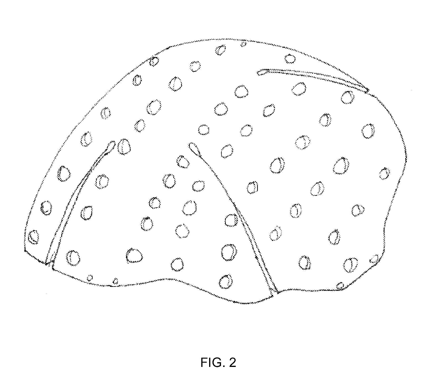 Cost-effective method for manufacturing metal cranial prostheses