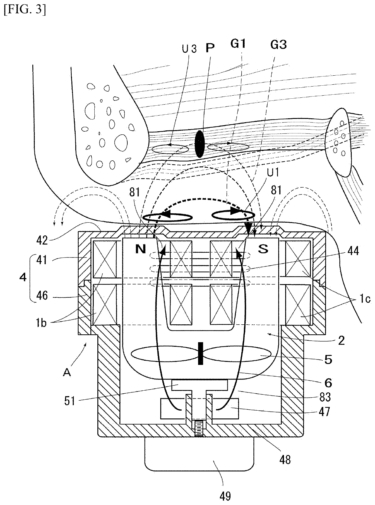 Magnetic stimulation device