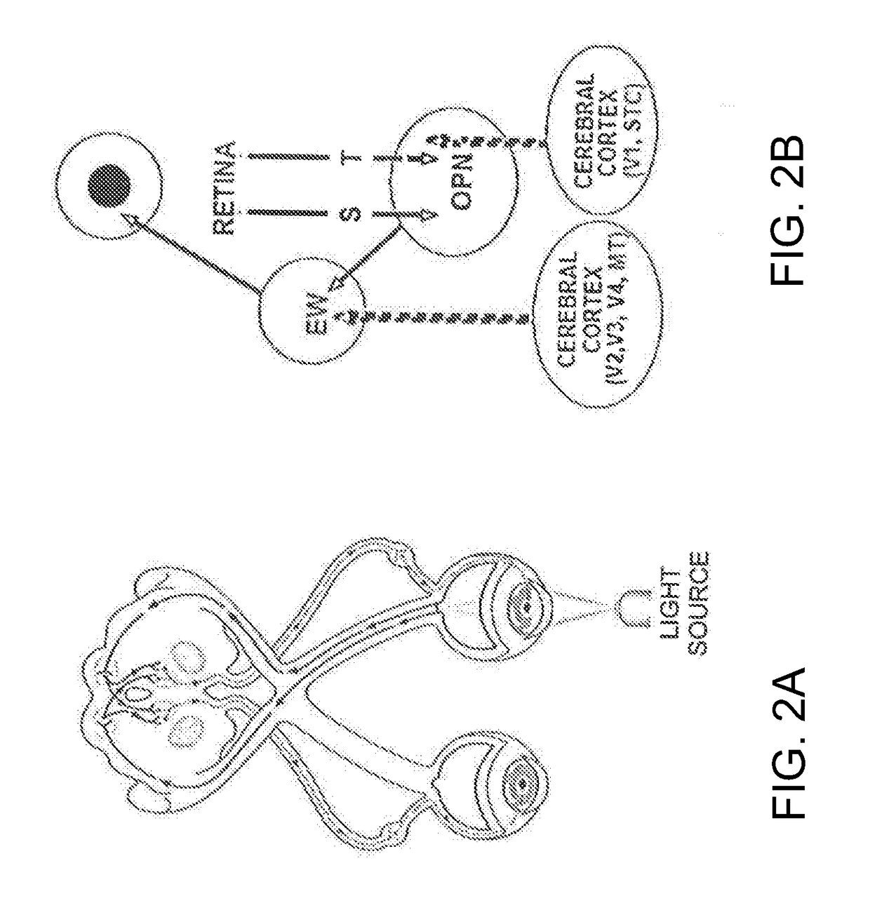 Method and system for pupillometric assessment of toxin exposure