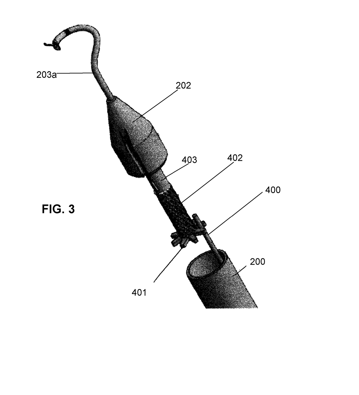 Reversible surgical suturing device