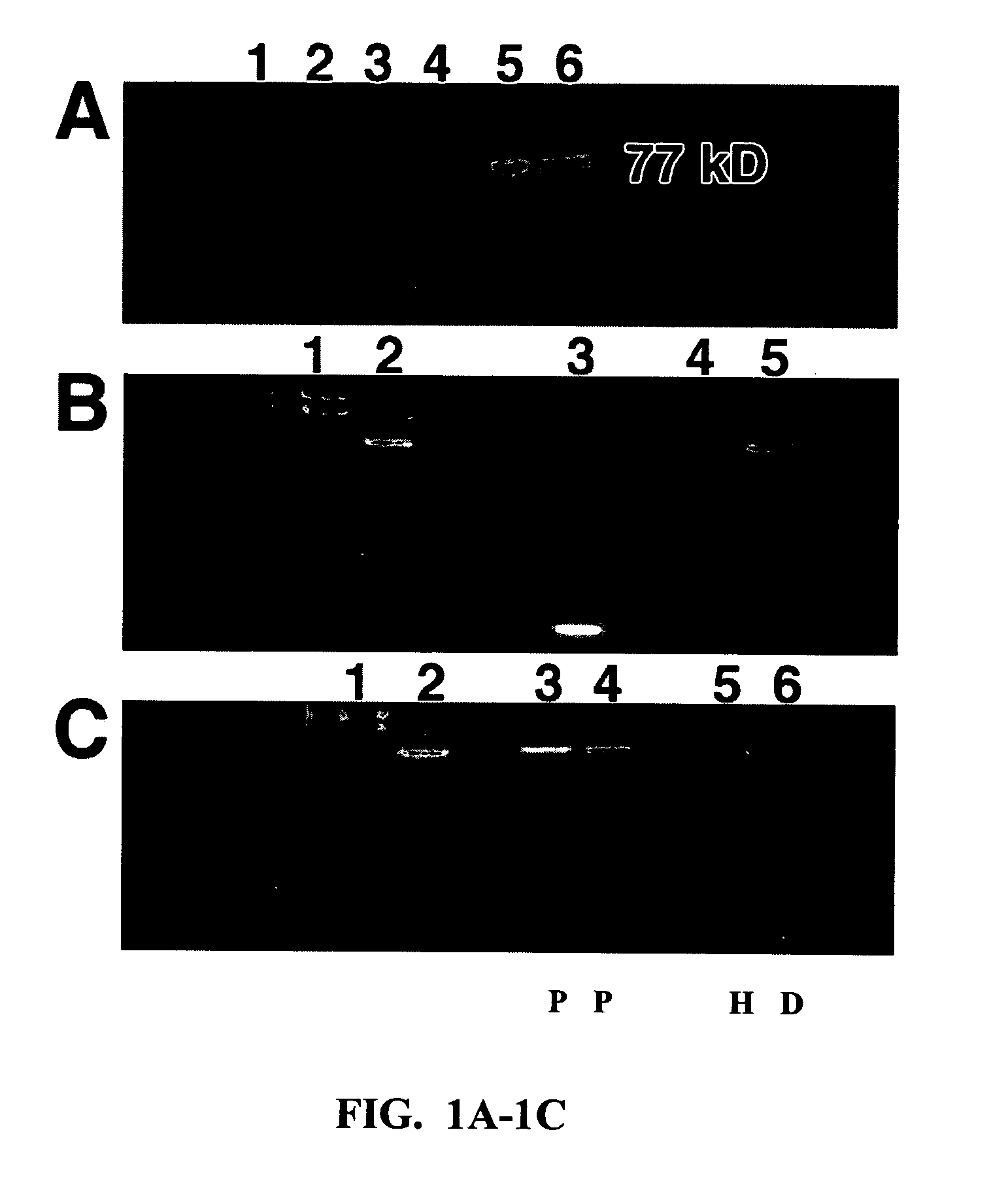 Methods and compositions related to 1-caldesmon