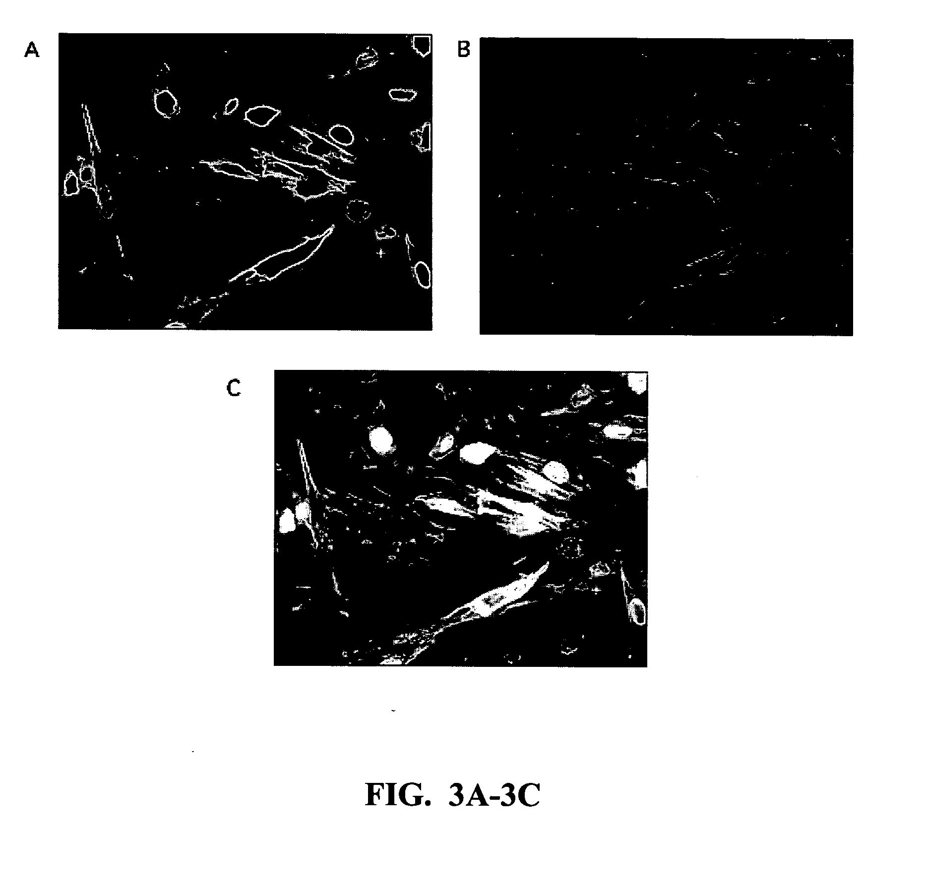 Methods and compositions related to 1-caldesmon