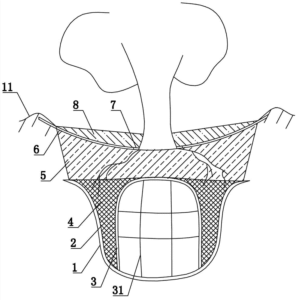 Construction method of water-storage drip irrigation system for plants