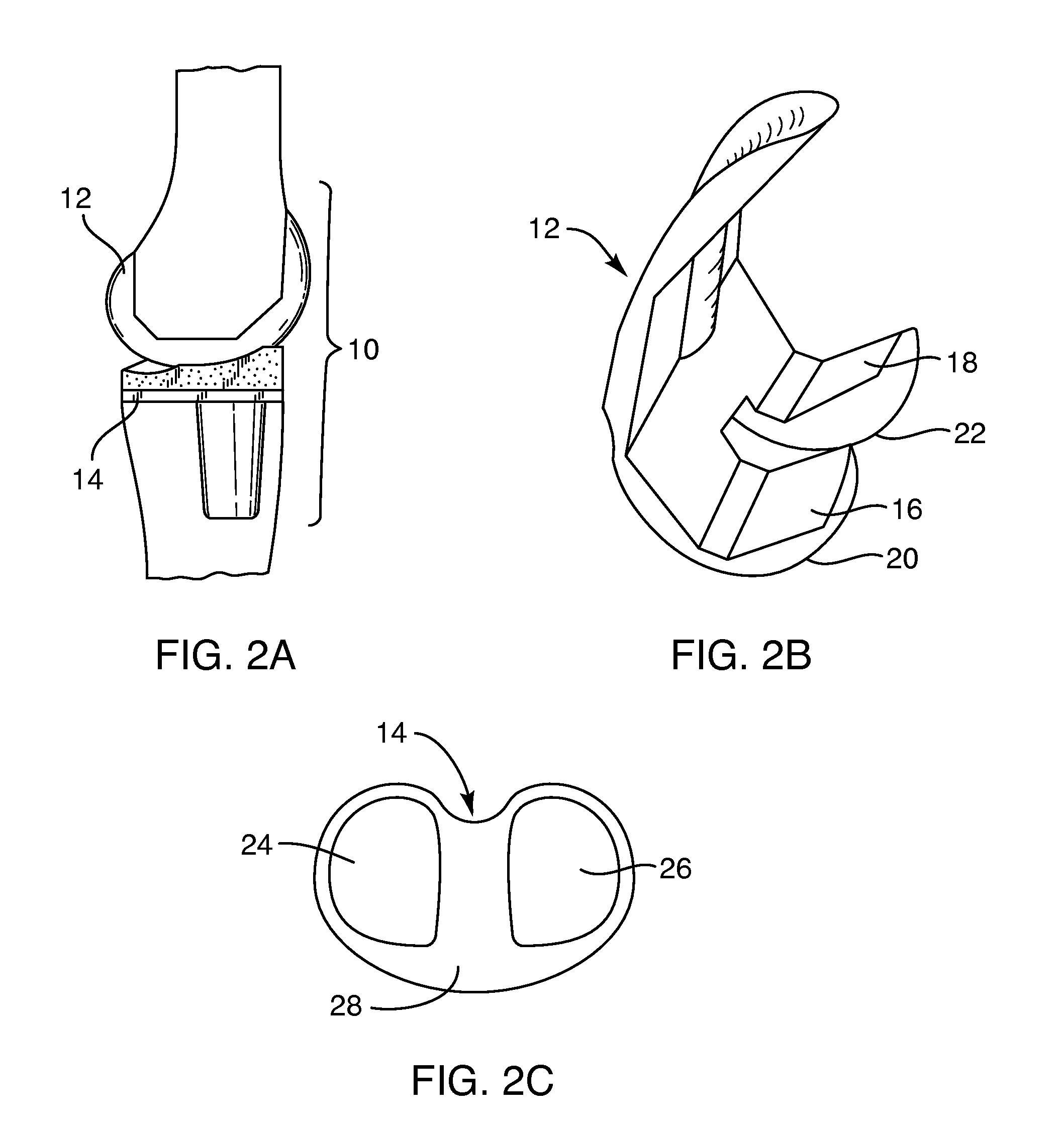 Systems and methods for providing a femoral resection block