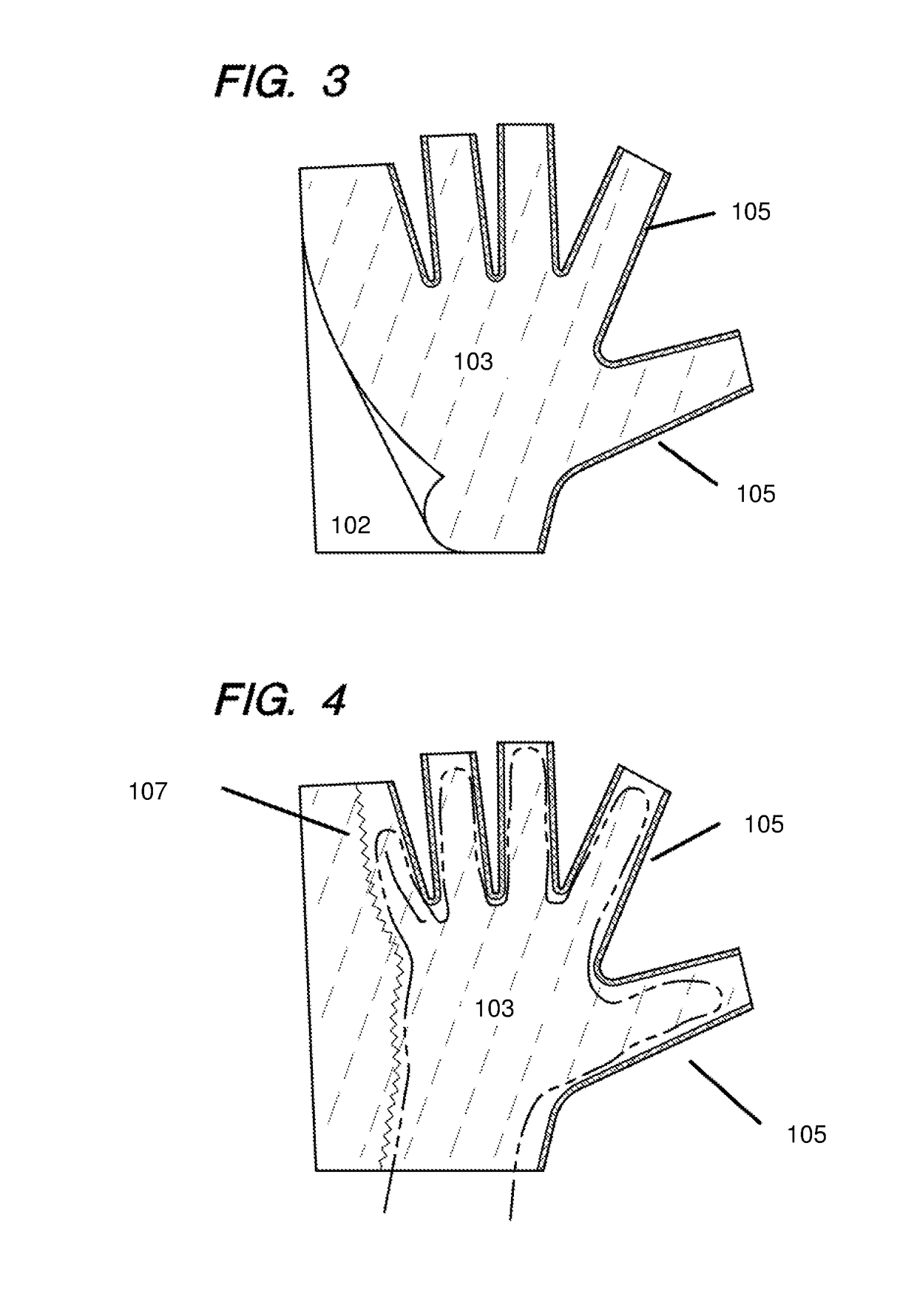 Glove and Sock Burn Dressing with Variable Pore Sizes