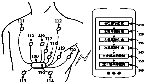 Periodic monitoring method and device based on premature beat signal in wearable electrocardiosignal