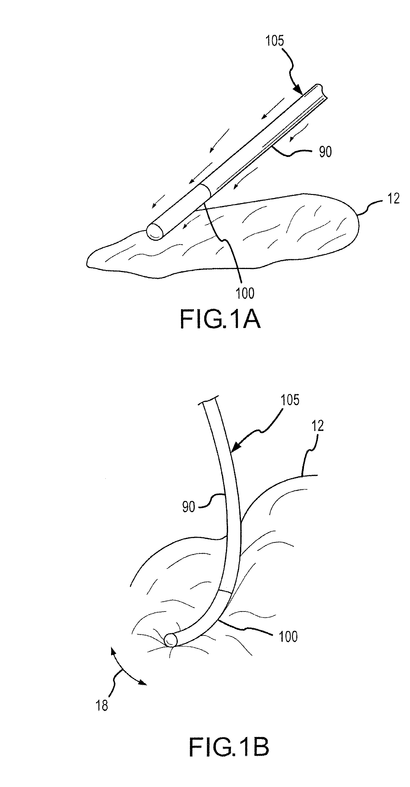 Adjustable length flexible polymer electrode catheter and method for ablation