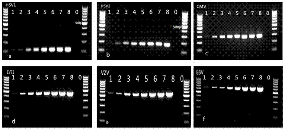 Multiplex-PCR kit for rapid diagnosis of viral encephalitis