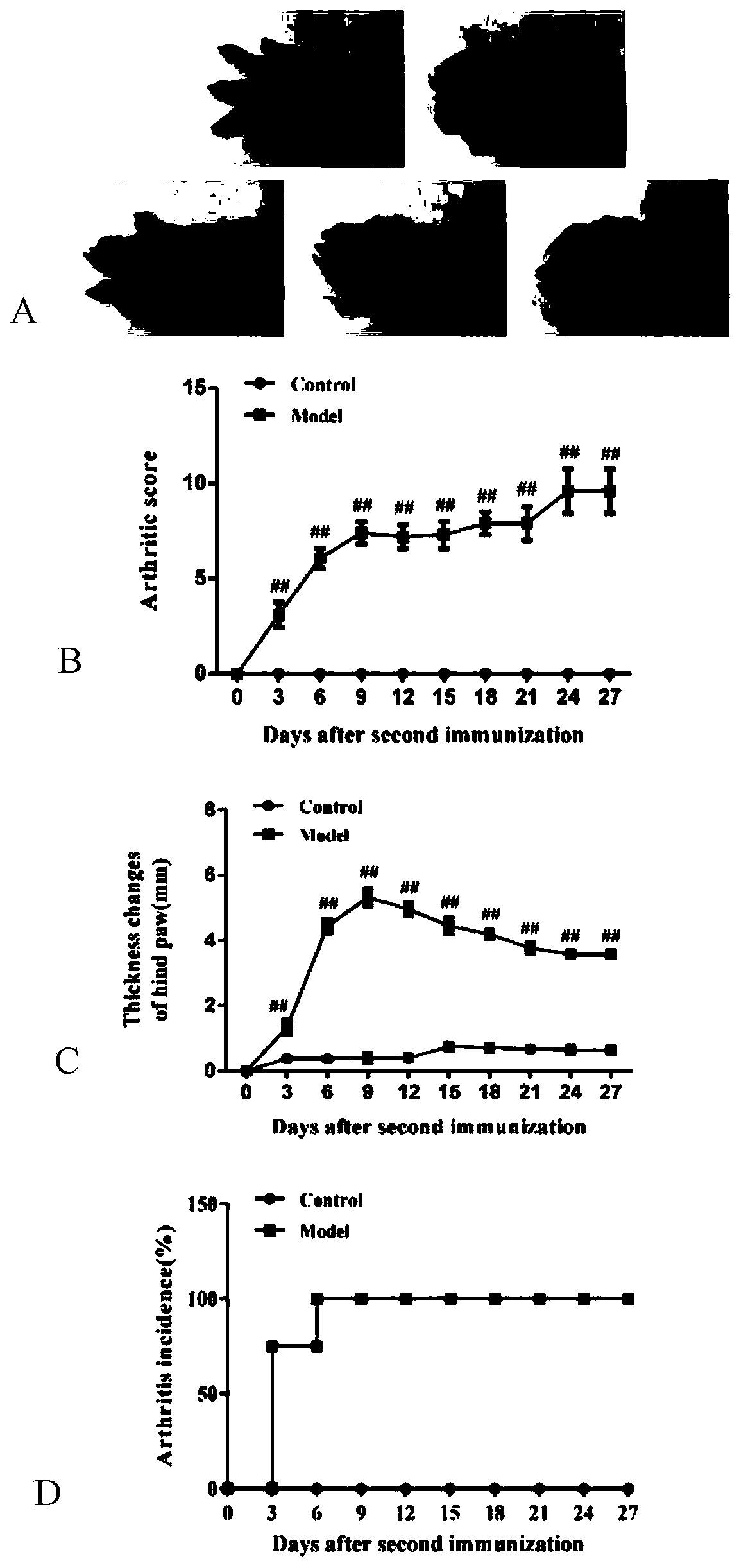 Diagnostic marker of bone destructive disease and application of diagnostic marker