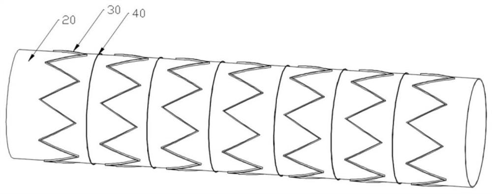 Structure for covered stent and covered stent