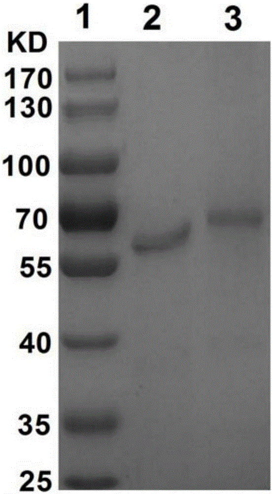 Method for acquiring human alpha fetoproteins